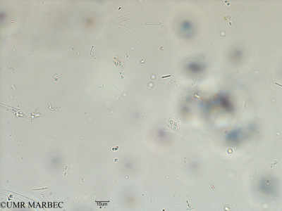 phyto/Scattered_Islands/iles_glorieuses/SIREME May 2016/Attheya sp (SIREME-Glorieuses2016-GLO5surf-31016-5-Chaetoceros-2)(copy)_thumb.jpg